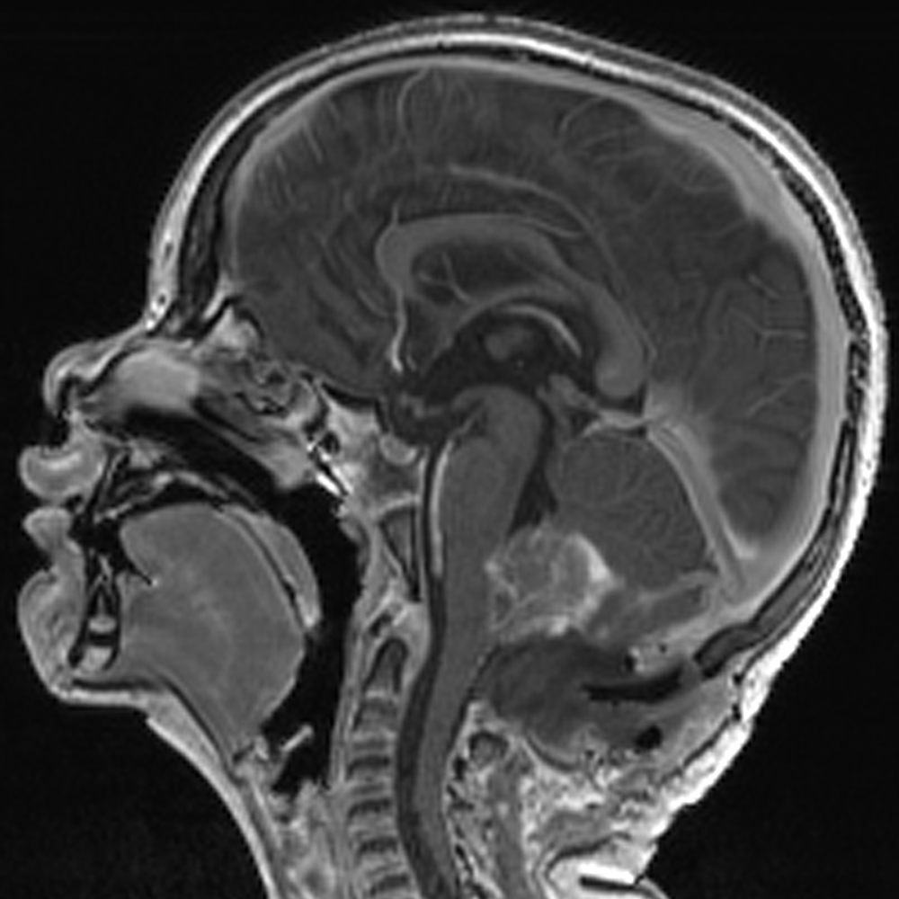 MB/MRI image